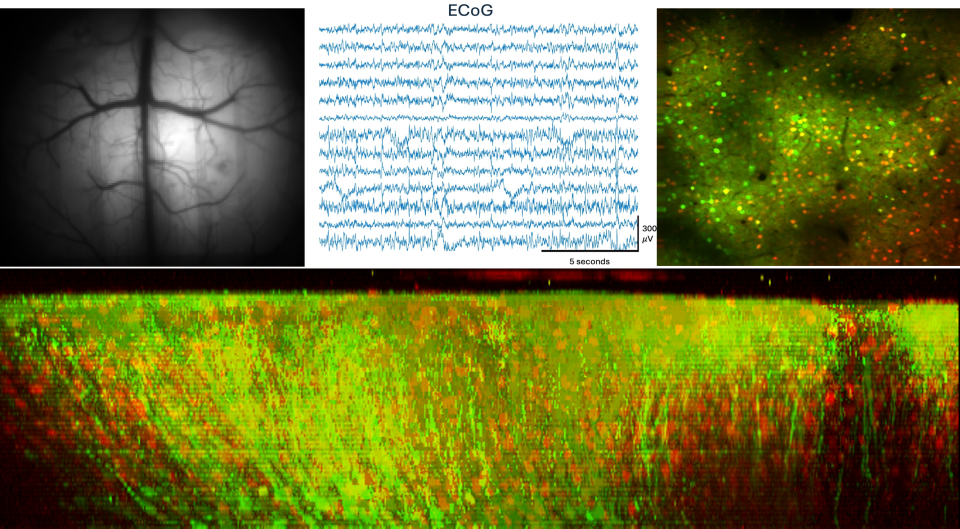 Composite scientific image showing multimodal brain data: a grayscale vascular brain image, an ECoG signal waveform plot, fluorescent microscopy with green and red neural cells, and a 3D volumetric reconstruction of neural tissue.